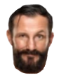 Bobby's head!